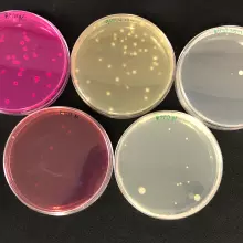Oxbugs strain collection